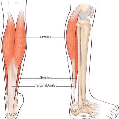 https://www.docteur-bertrand.be/medias/photos/pathologie/tendon%20achille%20%283%29.png